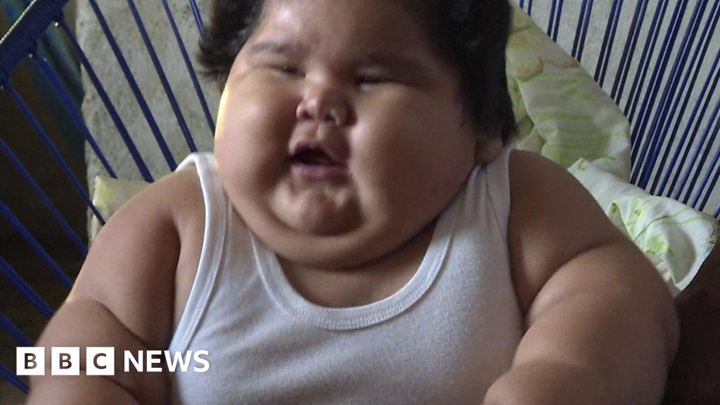 Why Is This Baby So Overweight BBC News    98708612 P05mrk3q 