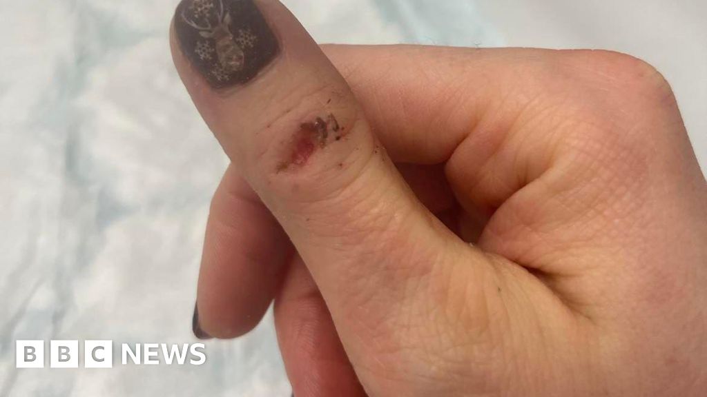 Basketball points finger at girls with dangerous nails