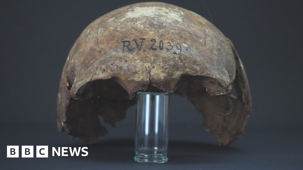5,000-year-old man was 'oldest plague victim'