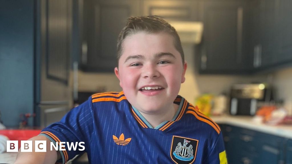 Some NI children to access givinostat drug