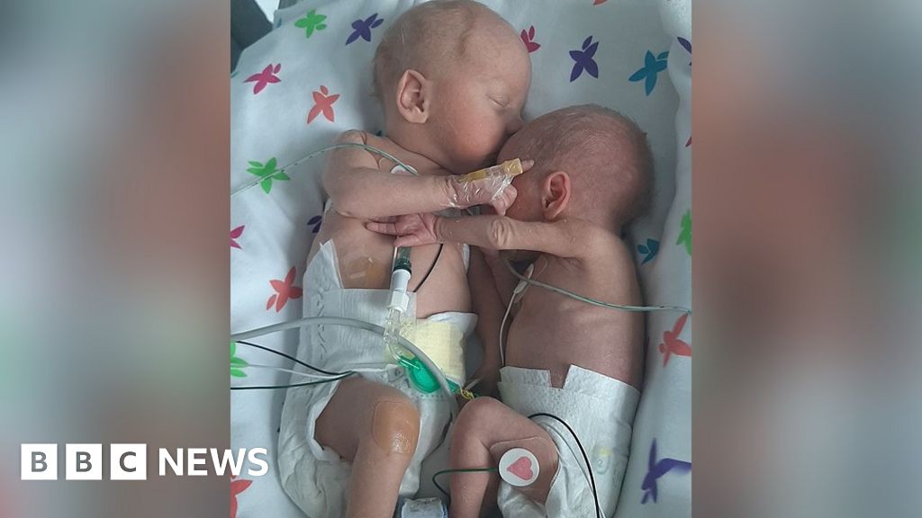 Liverpool twins separated at birth 'cuddle and hold hands' - BBC News