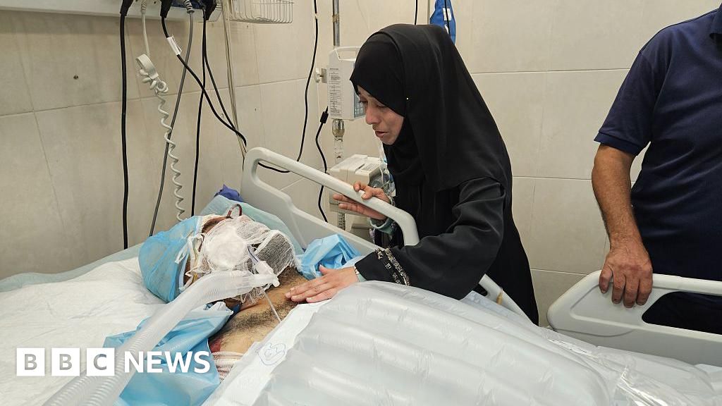 Gaza doctor whose nine children were killed in Israeli strike dies from injuries