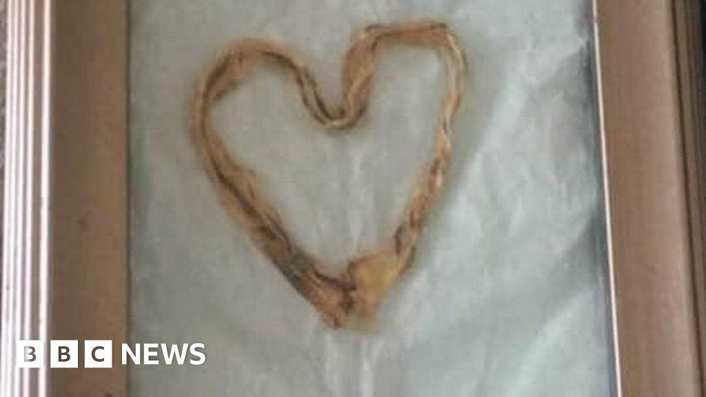 umbilical-cord-art-would-you-do-it-bbc-news