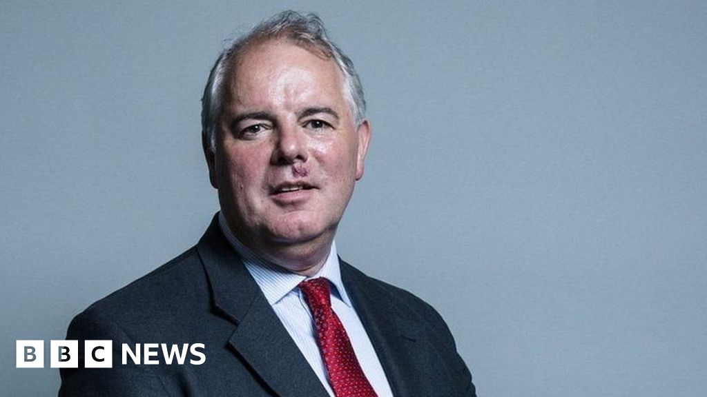 Richard Bacon: Conservative MP suggests NHS staff 'let their hair down'