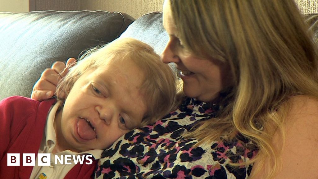Mother Horrified Over Images Mocking Disabled Daughter Bbc News 