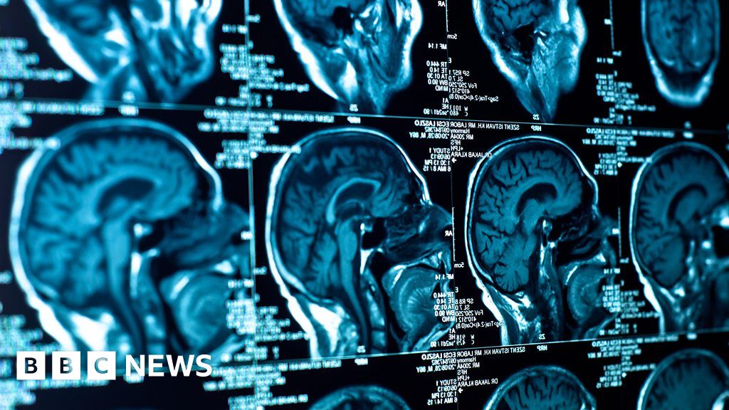 How liquid aspirin could kill brain tumours BBC News