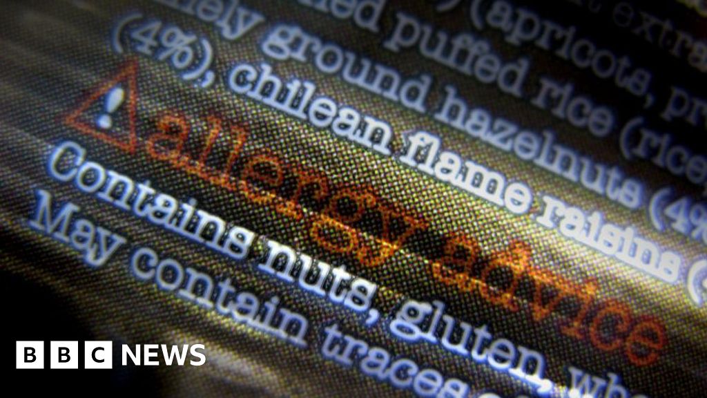 Views sought on plan for mandatory food allergen labels in Jersey