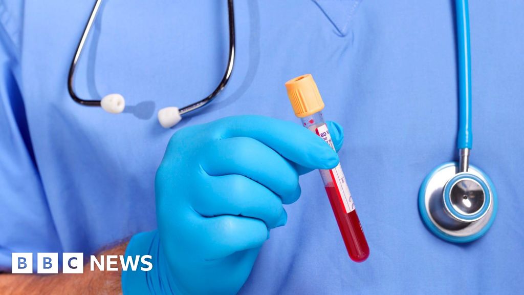 HIV 検出活動では、A&E で数千人が検査を受けている
