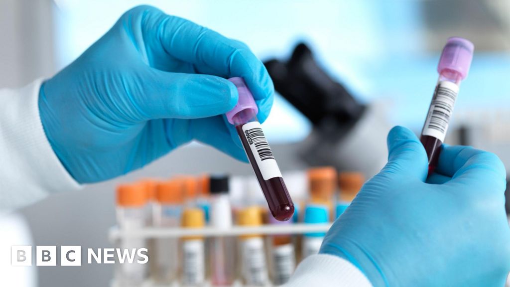 Two possible Ebola cases in Brazil ruled out as patients test negative