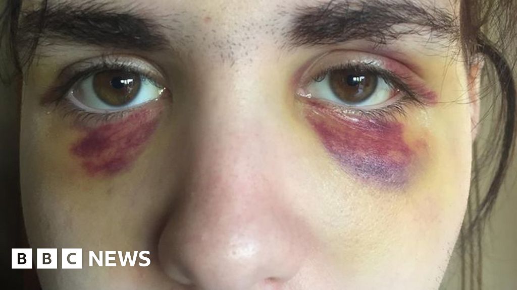 Gay Teen Beaten On Bristol Bus In Hate Crime BBC News