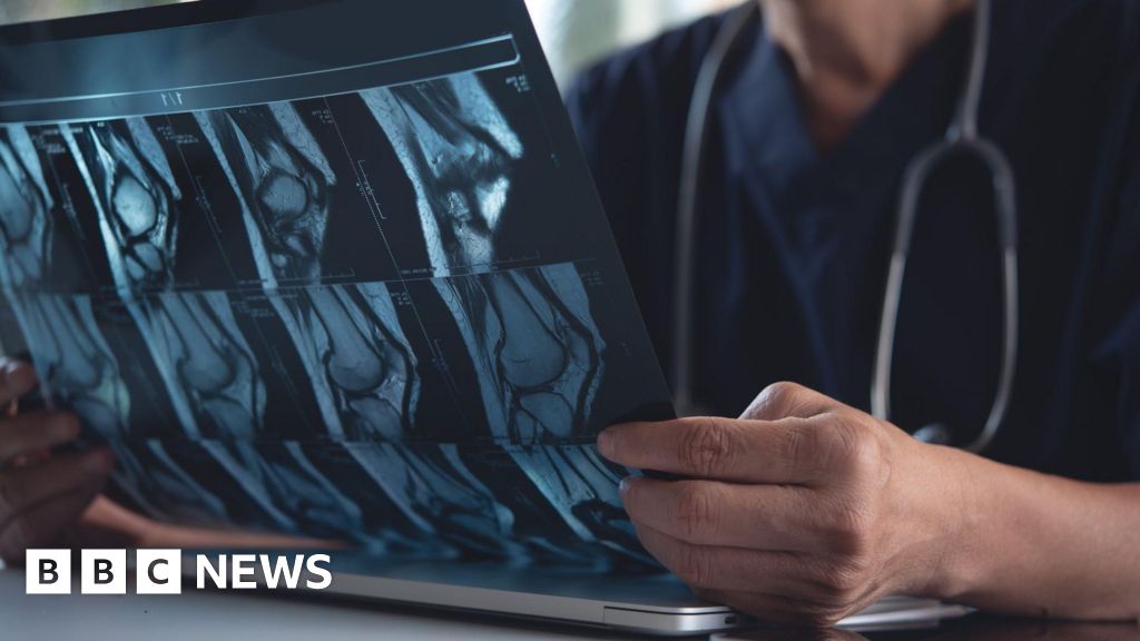 X-ray predicting AI could transform care – study