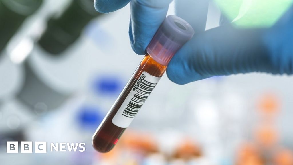 Thousands of people to trial Alzheimer's blood tests
