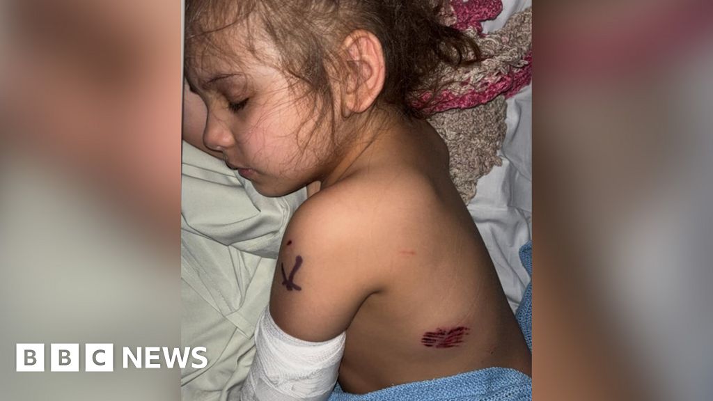 Carmarthen: Dog put down after four-year-old attacked – BBC.com