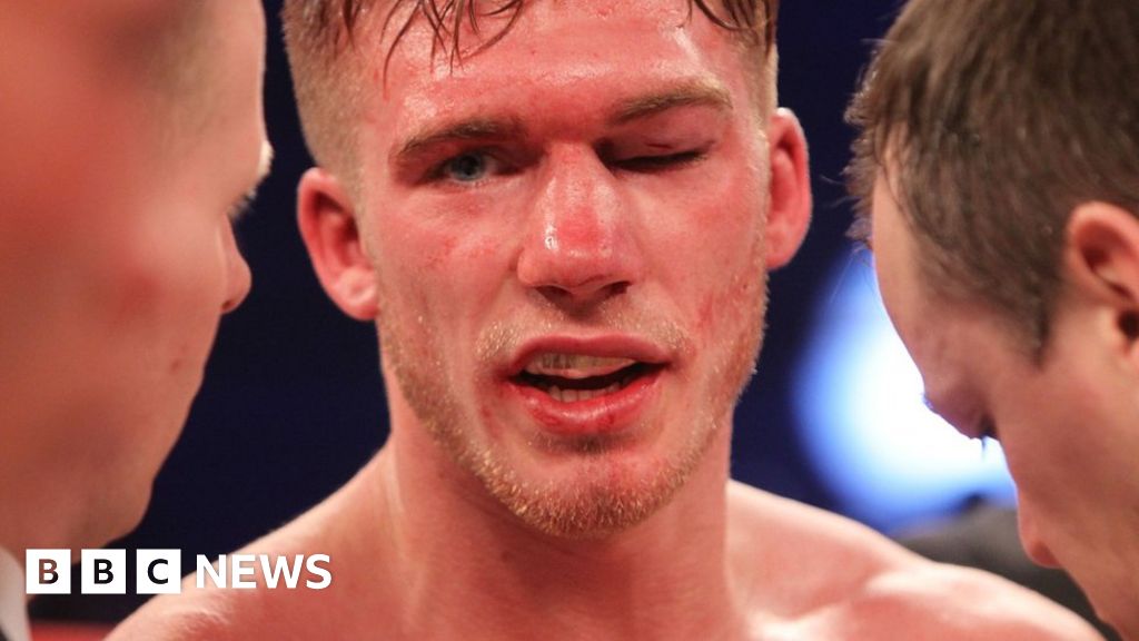 Nick Blackwell: What are the rules for stopping boxing bouts? - BBC News