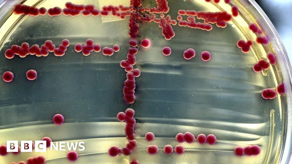 Antibioticresistant bacteria detected in Scotland BBC News