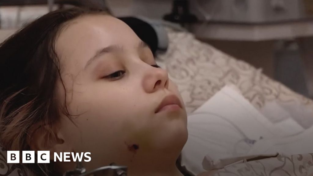 Ukraine conflict: The wounded children of Putin's war