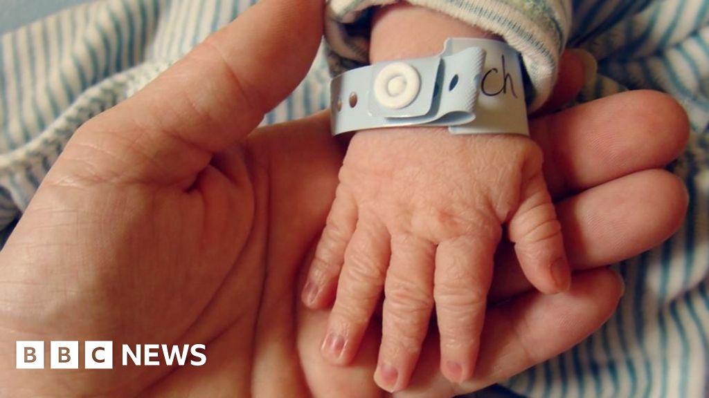 Madres en Forth Valley enfrentan esperas de hasta 62 horas para inducir parto