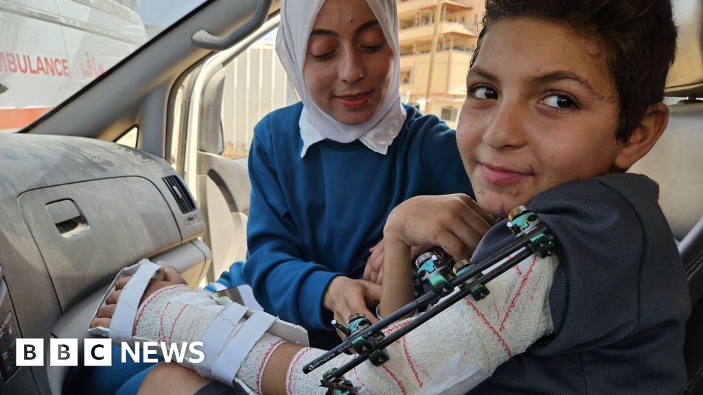 Gaza doctor whose nine children were killed in Israeli strike evacuated with son