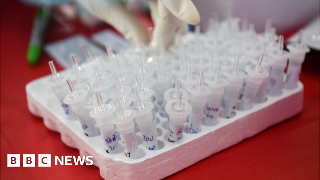 Coronavirus: Robin Swann concerned by rise in Covid-19 cases