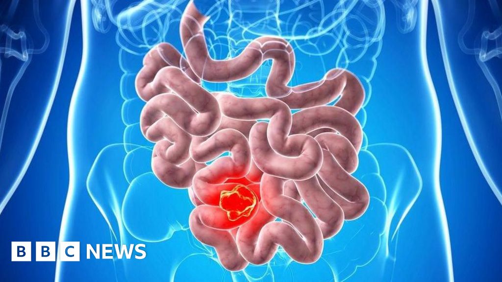 Scientists discover potential new treatment to tackle cancer