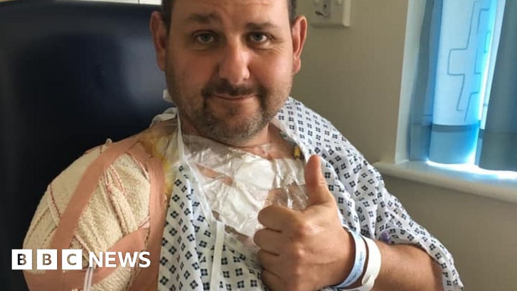10k Bionic Arm Bid For Warwickshire Farmer After Accident c News