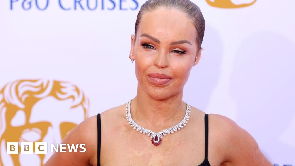 Katie Piper forced to withdraw from ITV show