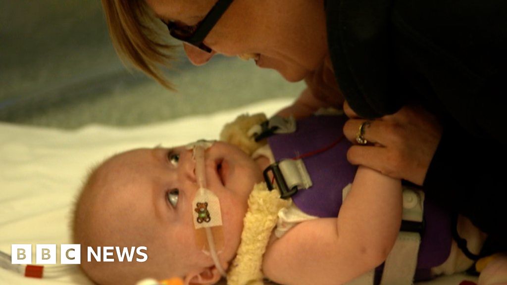 Baby born with heart outside body set to return home BBC News