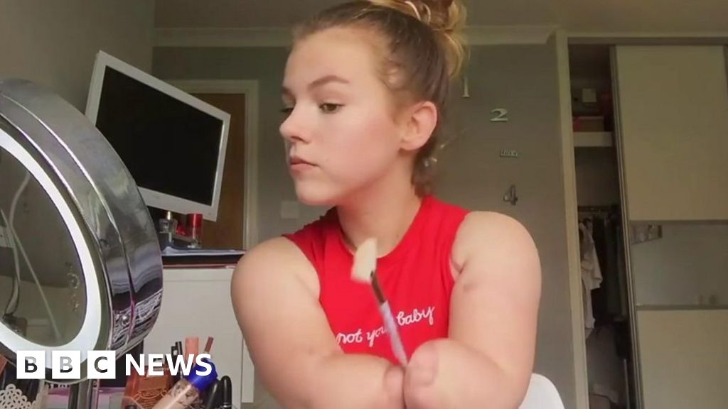 Teen Quadruple Amputee From Derby Aiming To Inspire Bbc News