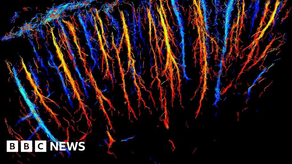 Ultrasound Captures Rat Brain In Microscopic 3d Bbc News