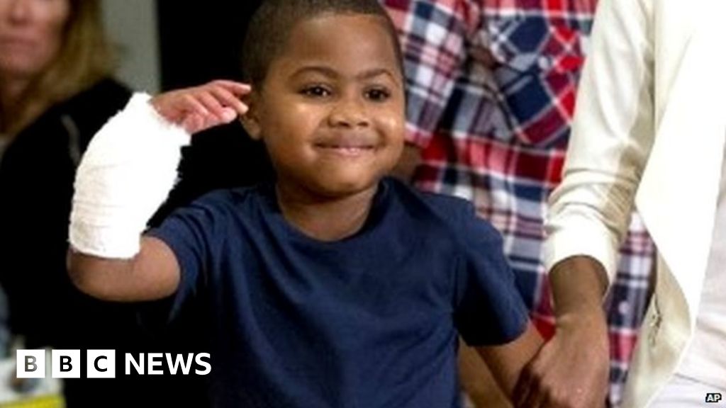 Zion Harvey, 8, youngest double hand transplant recipient BBC