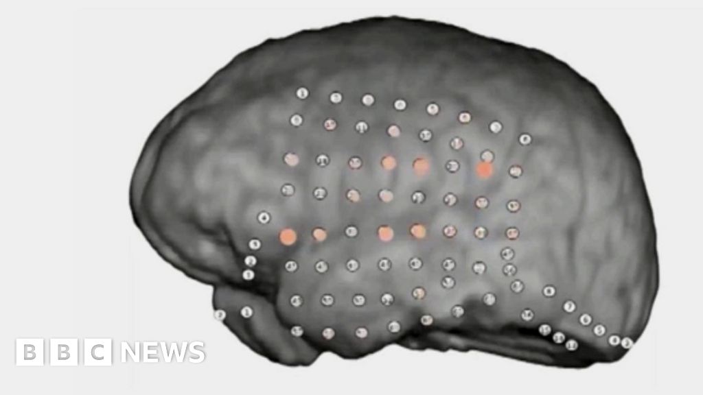 Brain's party noise filter revealed by recordings BBC News