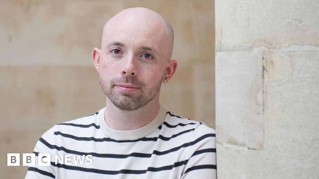 At 21, I was crushed by a stranger's joke about going bald. Then the way I looked at myself changed