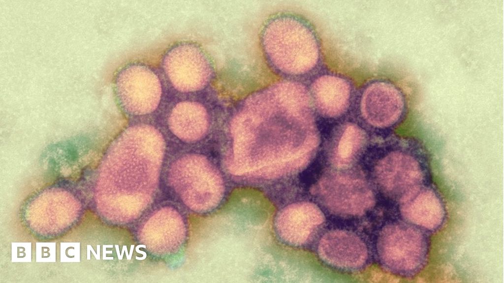 Грипп машина. Вирус гриппа под микроскопом h1n1. Вирус гриппа а h1n1/09. Свиной грипп под микроскопом. Свиной грипп фото вируса.
