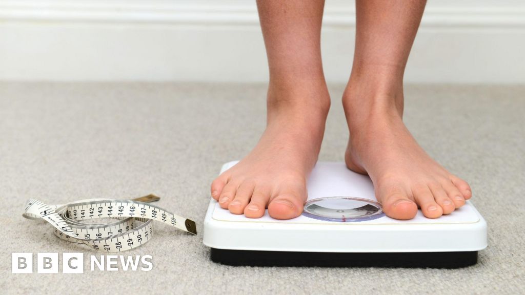 Childhood obesity on the rise in poor areas