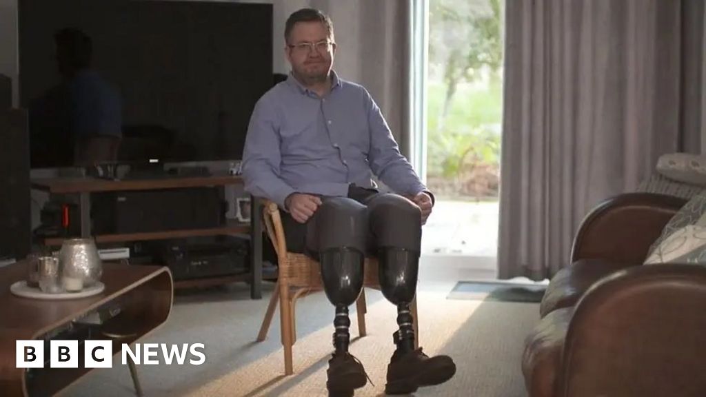 Surgeon jailed after amputation of own legs
