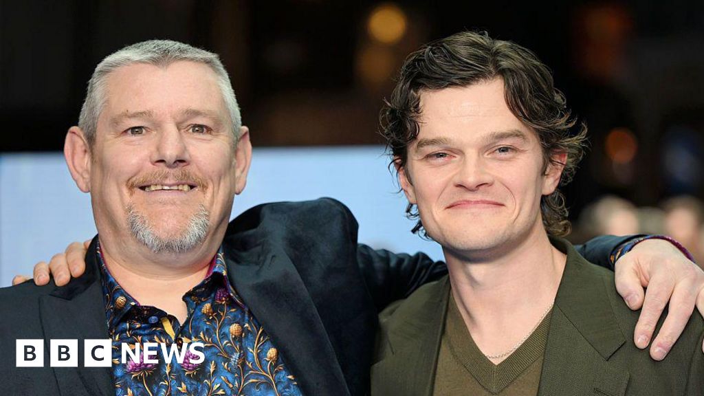 Hull's Robert Aramayo says Tourette's film I Swear was a challenge