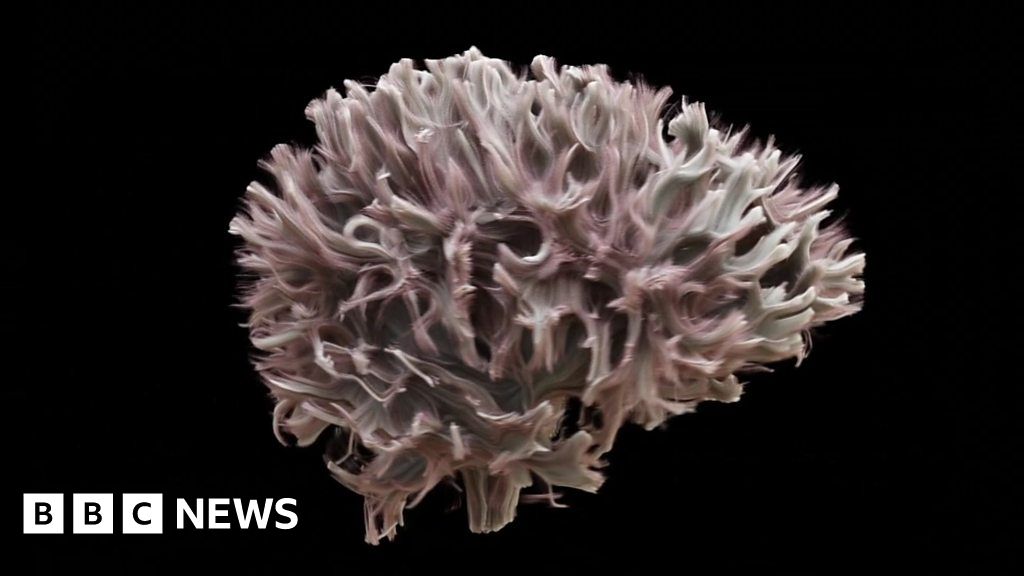 The most detailed scan of the wiring of the human brain - BBC News