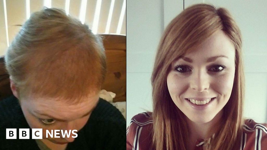I pulled out my own hair for nine years' - BBC News