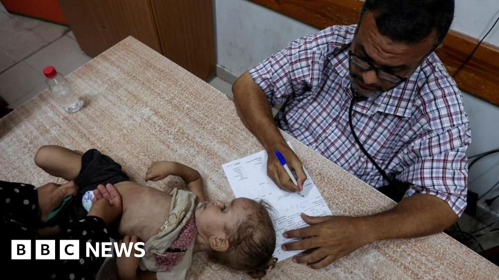 Baby contracts Gaza’s first case of polio in 25 years