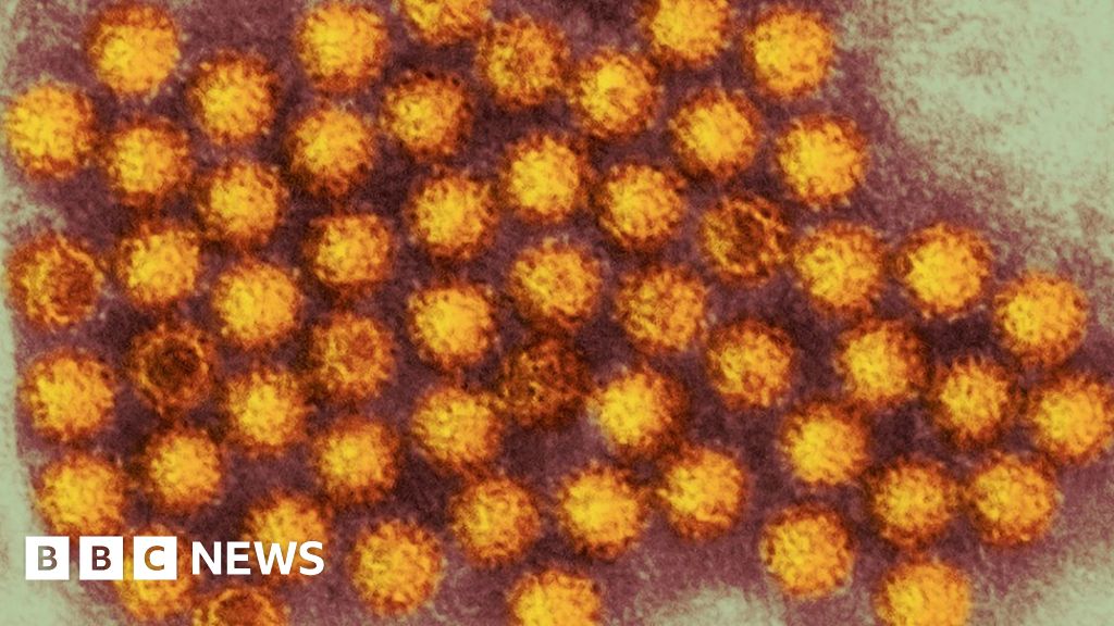 Jersey Warning After Norovirus Outbreak BBC News    85507553 Norovirus 