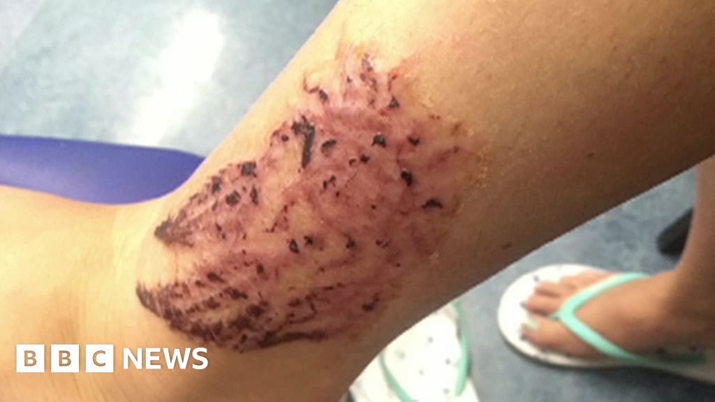 Warning over black henna tattoos BBC News