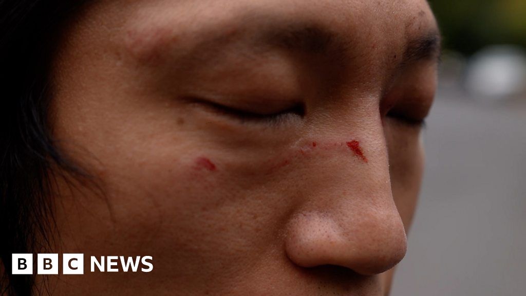 Protester beaten up in China consulate grounds