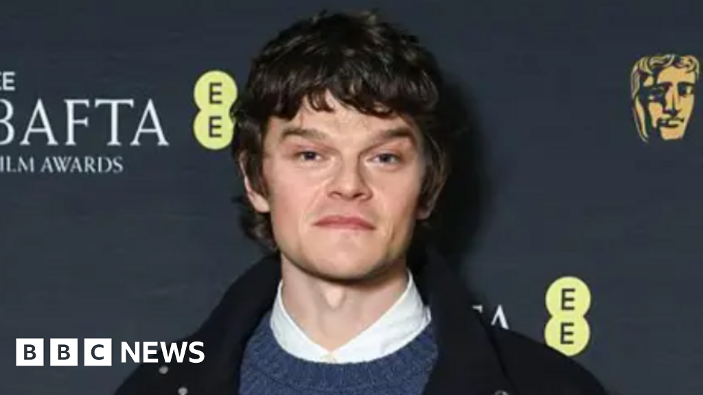 Vibrant Robert Aramayo's Bafta Win And The Unfortunate Incident That May Have Cost An Oscar Nod Scene in HD Vibrant Robert Aramayo's Bafta Win And The Unfortunate Incident That May Have Cost An Oscar Nod Scene in HD