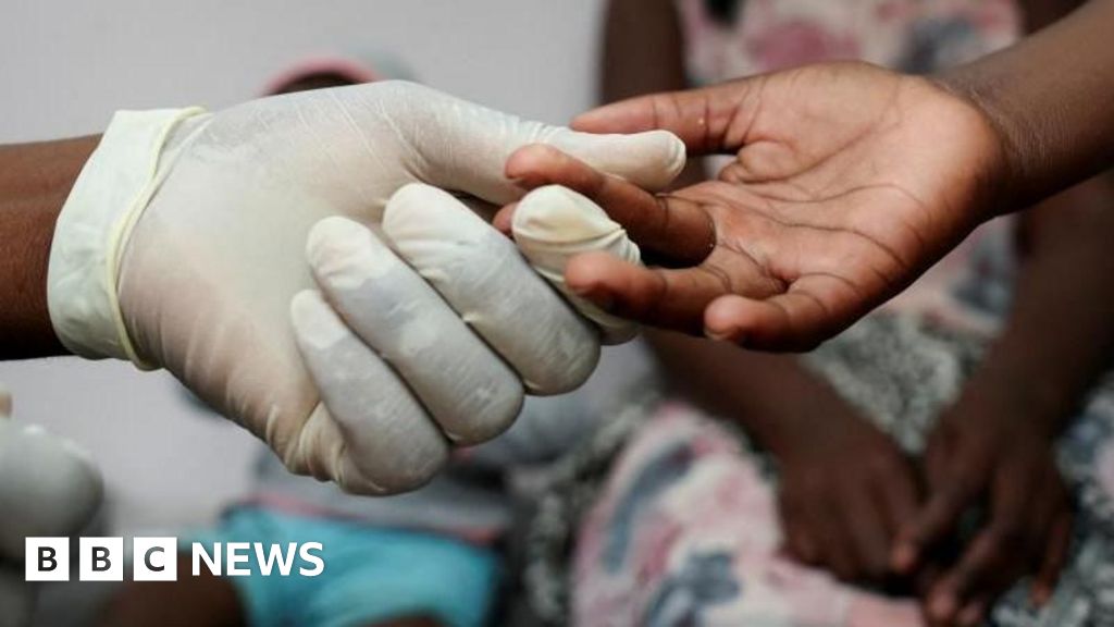 US aid cuts: South Africa's HIV/Aids patients worry about treatment thumbnail