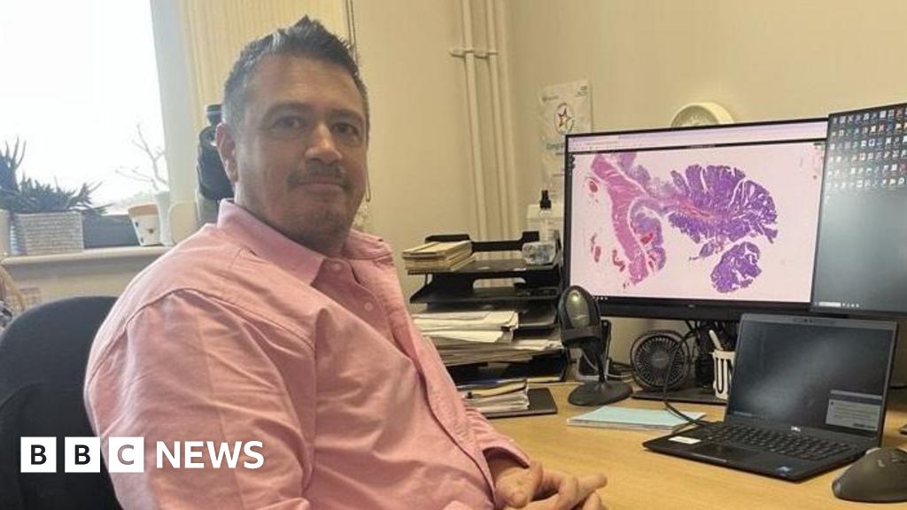 'Huge pressure' in Royal Surrey County Hospital histopathology