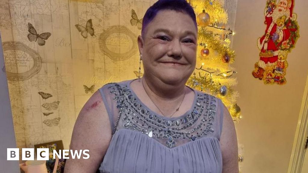 Cancer diagnoses “too late” for people with learning disabilities | Manchester News