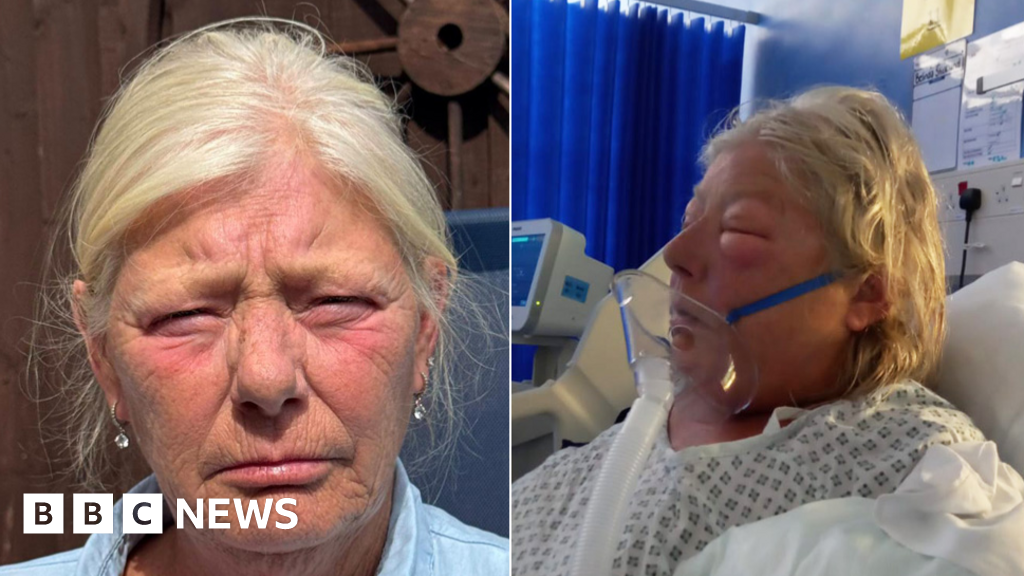 Gran punched by pregnant attacker at funeral disgusted at sentence