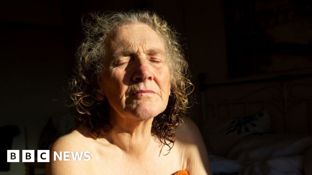 Demencja: Zdjęcia ukazują agonię związaną z powolną utratą matki