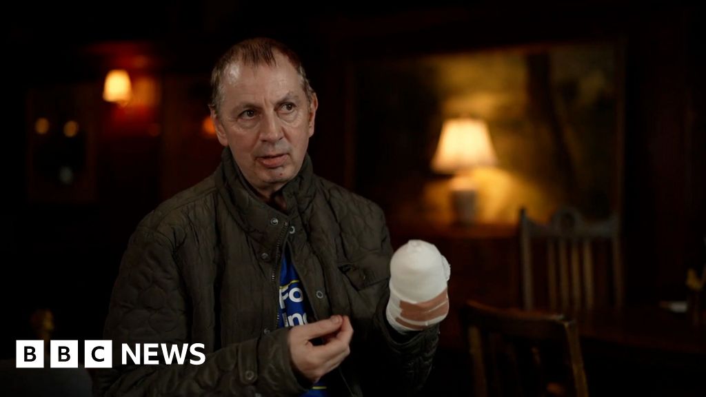 'Do you want to die?: Train attack victim describes confrontation with alleged attacker