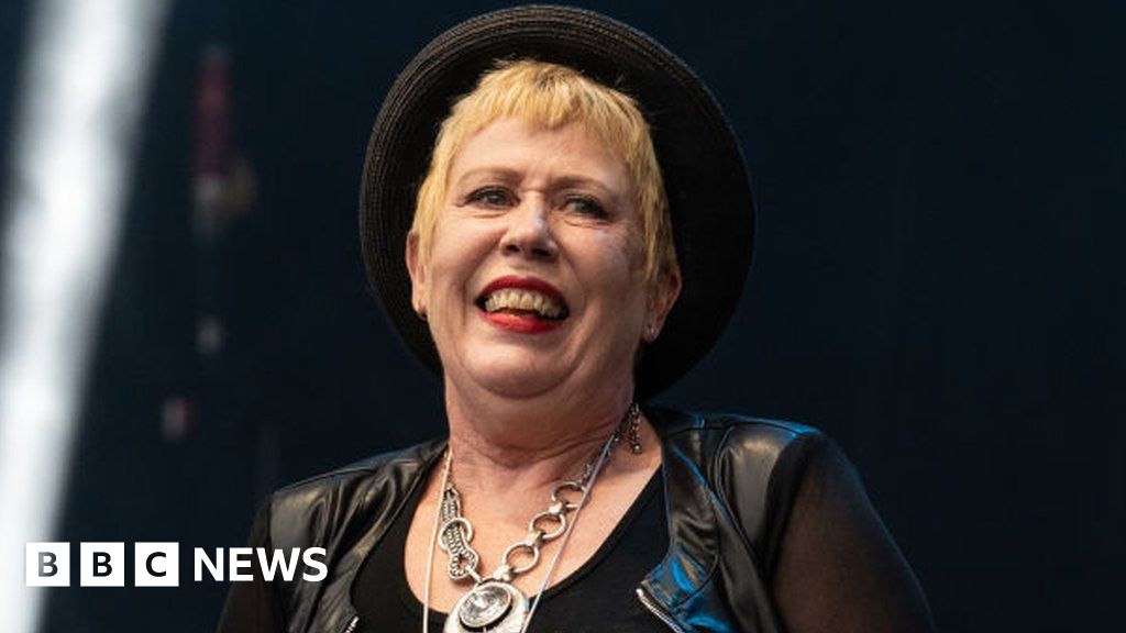 hazel-o-connor-expected-to-recover-from-brain-bleed